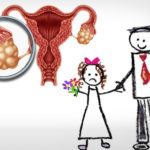 পলিসিস্টিক ওভারি সিনড্রম হলে তাড়াতাড়ি বিয়ে নয়!